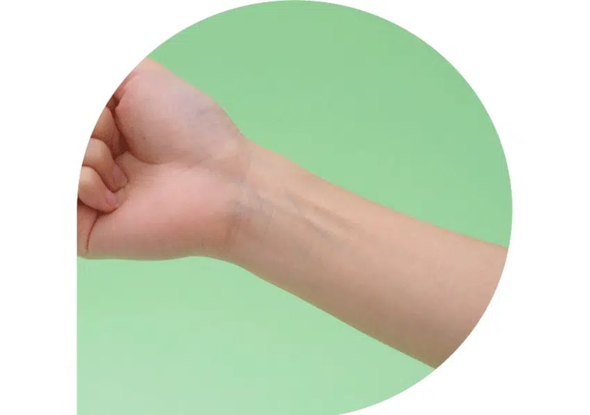 아크네스의  
트러블 & 민감 피부 전문  
다이소 전용 스킨케어 라인  
WHITE TEA TREE  
by Acnes  
민감 트러블 피부  
데일리 진정 케어  
*트러블:민감, 자극, 건조(수분손실) 등에 기인한 피부 고민  
WHITE TEA  
Acnes WHITE TEA TREE  
Acnes  
WHITE TEA TREE  
After-care  
Spot Patch  
아크네스 화이트 티트리 애프터케어 스팟패치  
\2,000 짜고난후  
계산  
COMPU  
WHITE TEA TREE  
White Tea Tree  
After-care SpotPatch  
화이트 티트리 애프터케어 스팟패치  
맑고 깨끗하게 애프터 케어  
짜고난뒤  
화이트 티트리 잎 추출물  
□ 나이아신아마이드  
Acnes  
맑고 깨끗하게  
애프터케어  
이런 분이라면 꼭 사용해보세요  
짜고난 후 스팟케어가 필요한 분  
메이크업 위에도 자연스럽게 사용할 수 있는 패치를 찾는 분  
트러블 부위에 외부 자극을 막아주고 싶은 분  
*민감, 자극, 건조(수분손실) 등의 피부 고민  
Check Point  
트러블 스팟 맑고 깨끗하게 애프터 케어  
진정된 산뜻한 피부로 케어  
애프터케어 핵심 케어  
화이트티트리 & 나이아신아마이드가 함유된 애프터 스팟 케어  
티 안 나는 초슬림 커버  
밀착력 강한 하이드로콜로이드 패치로 작은 스팟에도 밀-착 케어  
*민감, 자극, 건조(수분손실) 등의 피부 고민  
**색소침착, 기미와 주근깨 같은 다크스팟  
After  
맑고  
White Tea Tree  
After care Spot Patch  
화이트 티트리 애프터케어 스팟까지  
맑고 깨끗하게 애프터  
- 짜고난뒤  
,  
Acnes  
- 화이트티트리잎오일  
- 병풀추출물  
- 나이아신아마이드  
계산  
10mm 바코드  
8매 150H  
화이트 티트리 에프  
TREE  
총23매  
10mm WHITE TEA 8매 15매  
White Tea Tree  
₩2,000 티트리 애프터케어 스팟패치  
After-care Spot Patch  
계산 화이트  
바코드  
맑고 깨끗하게  
WHITE TEA  
착 붙이고 감싸듯 누르면 감쪽같이 피부에 착 붙어 고민 부위를 진정시키고 스팟 부위를 눈에 띄지 않게 보호해요  
*상기 내용은 원료적 특성에 한함  
*민감, 자극, 건조(수분손실) 등의 피부 고민  
**색소침착, 기미와 주근깨 같은 다크스팟  
2  
아크네스 화이트 티트리의 트러블 케어  
#White tea tree  
#화이트티트리잎오일  
3가지 티트리 중 진정 케어 성분인 '알파피넨' 함량이 가장 높아 피부 진정 케어를 해줍니다.  
#niacinamide  
#나이아신아마이드  
피부를 한층 맑게 케어해 줍니다  
*트러블 :민감, 자국, 건조(수분손실) 등에 기인한 피부 고민  
*상기 내용은 원료적 특성에 한함  
3  
초밀착 스킨핏 패치  
가장자리가 얇은 베벨링 패치가 진정이 필요한 트러블에 들뜸 없이 밀착!  
0.16mm  
로이드  
8mm 10mm  
2가지 사이즈 패치로 트러블 크기에 맞춰 착!  
밀착력 강한 초슬림 패치로 헤어라인 등 작은 스팟에도  
메이크업 전 & 후에 언제든 애프터 케어하세요.  
HOW TO USE  
부착 부위를 물기나 유분기 없이 깨끗하게 건조시켜주세요  
칼선을 따라 박리지를 뜯어 고민 부위에 붙여주세요  
부착 후, 손바닥으로 감싸듯 2-3초간 눌러주세요  
제품이 하얗게 부풀어 올라 더 이상 부착이 어려울 경우, 제품을 가장자리부터 조심스럽게 떼어 주세요  
Acnes WHITE TEA TREE  
WHITE TEA TREE  
트러블 진정 케어라인  
STEP. 1  
순하고 산뜻한 데일리 클렌징 케어  
폼클렌저 포밍워시  
#뽀득개운 #촉촉산뜻  
#약알칼리폼 #펌핑버블폼  
STEP.2  
민감 피부 저자극 진정 케어  
카밍토너 스팟크림  
#수분진정 #수시로진정  
#워터타입  
STEP.3  
티 안 나게 착! 짜기 전 스팟케어  
트러블 커버 스팟 패치  
#짜기전 #집중진정  
티 안 나게 착! 짜고난후 스팟케어  
애프터 케어 스팟 패치  
#짜고난뒤 #애프터케어  
본 상품 정보, 상용, 상세 상품 설명 등의 내용은 협력사가 직접 작성한 것입니다.  
제품명 아크네스 화이트 티트리 애프터케어 스팟패치  
용량 총23매(8mmx8매, 10mmx15매)  
제품 주요 사양 모든 피부 타입  
개봉 사용 기한 또는 기간 개봉 전 36개월, 개봉 후 즉시  
사용 방법 상세 페이지 참조  
기능성 유무 해당 없음  
셀룰로오스검, 하이드로제네이티드폴리(C6-20올레핀) 폴리아이소부텐,  
전성분 스타파란에이소프렌트폴리머, 화이트 티트리 크림(7000ppm, L1000-  
신아마이드, 병풀추출물, 정제수, 1,2-헥산다이올  
화장품 제조업자 (주)와이앤케이바이오코스  
화장품 책임 판매업자 맨소래덤아시아퍼시픽(주)  
가. 화장품 사용 시 붉은 반점, 부아 오름 또는 가려움증을 포함한 이상 증상 또는 부작용이 있는 경우 전문의 등과 상담할 것  
사용 시 주의사항  
나. 상처가 있는 부위 등에는 사용을 금지할 것  
주의사항  
다. 보관 및 취급 시 주의사항  
1) 어린이의 손이 닿지 않는 곳에 보관할 것  
2) 직사광선을 피해 보관할 것  
본 제품에 이상이 있을 경우 공정거래위원회 고시 소비자 분쟁 해결 기준에 의거 교환 또는 보상받을 수 있습니다.  
소비자 상담실 02)717-1821